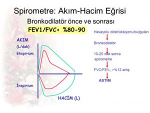 cocuklarda astim